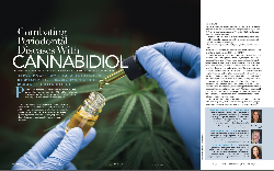 Feature design for America's network on the uses of cannabidiol in dental therapy